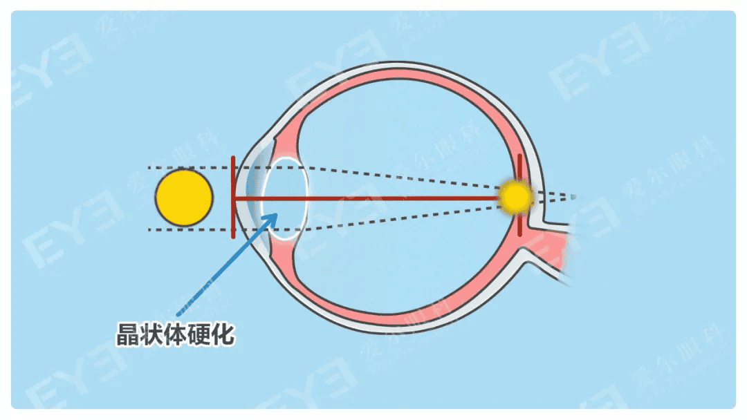 640.webp (3).png